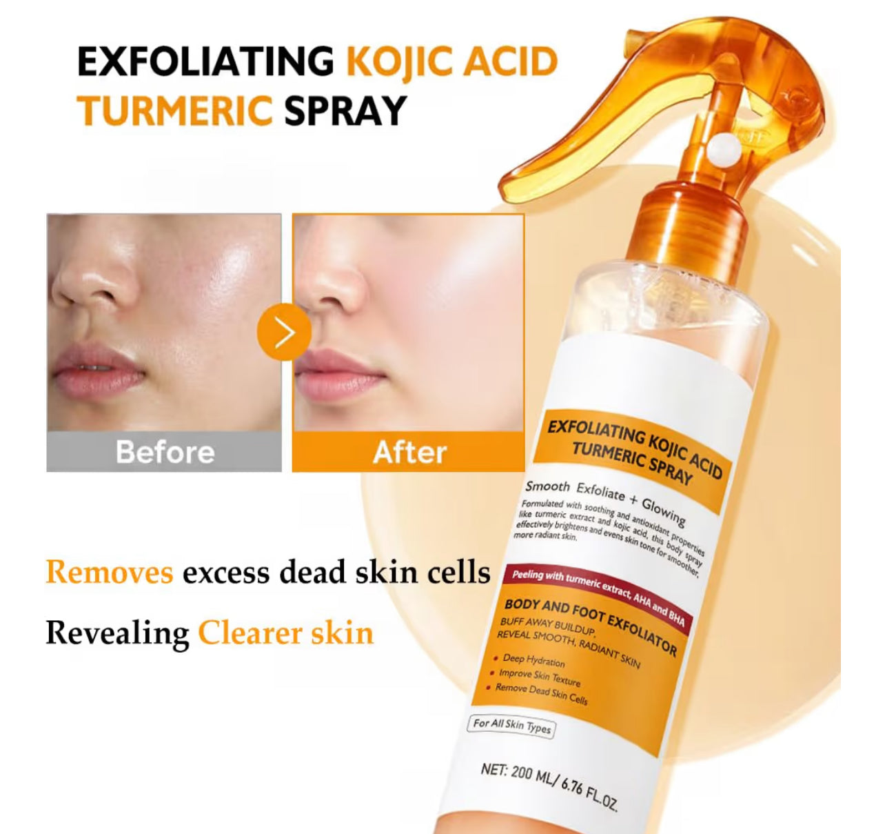 Lumi Kojic Acid and Tumeric Dark Spot Remover Spray