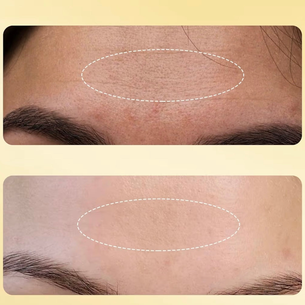 Lumi Kojic Serum | Hydrating Facial Serum